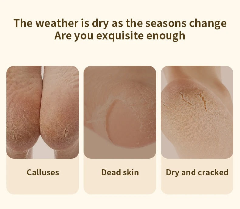 Electric Callus Remover – مبرد كهربائي لإزالة الجلد الميت